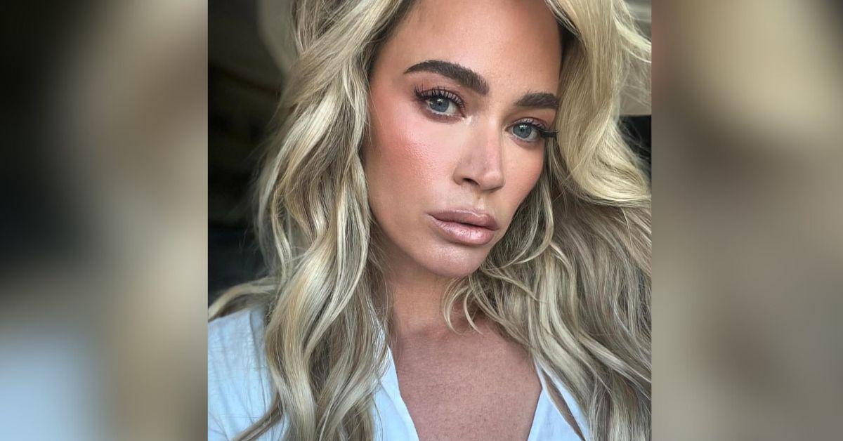 teddi mellencamp shows gruesome scars brain cancer battle