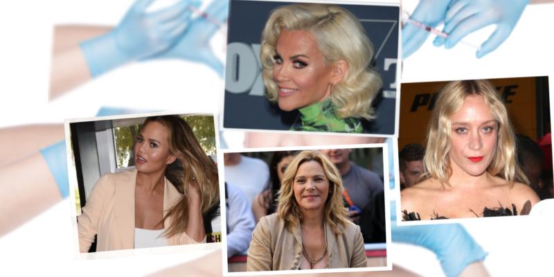 celebrities-who-love-getting-botox-postpic